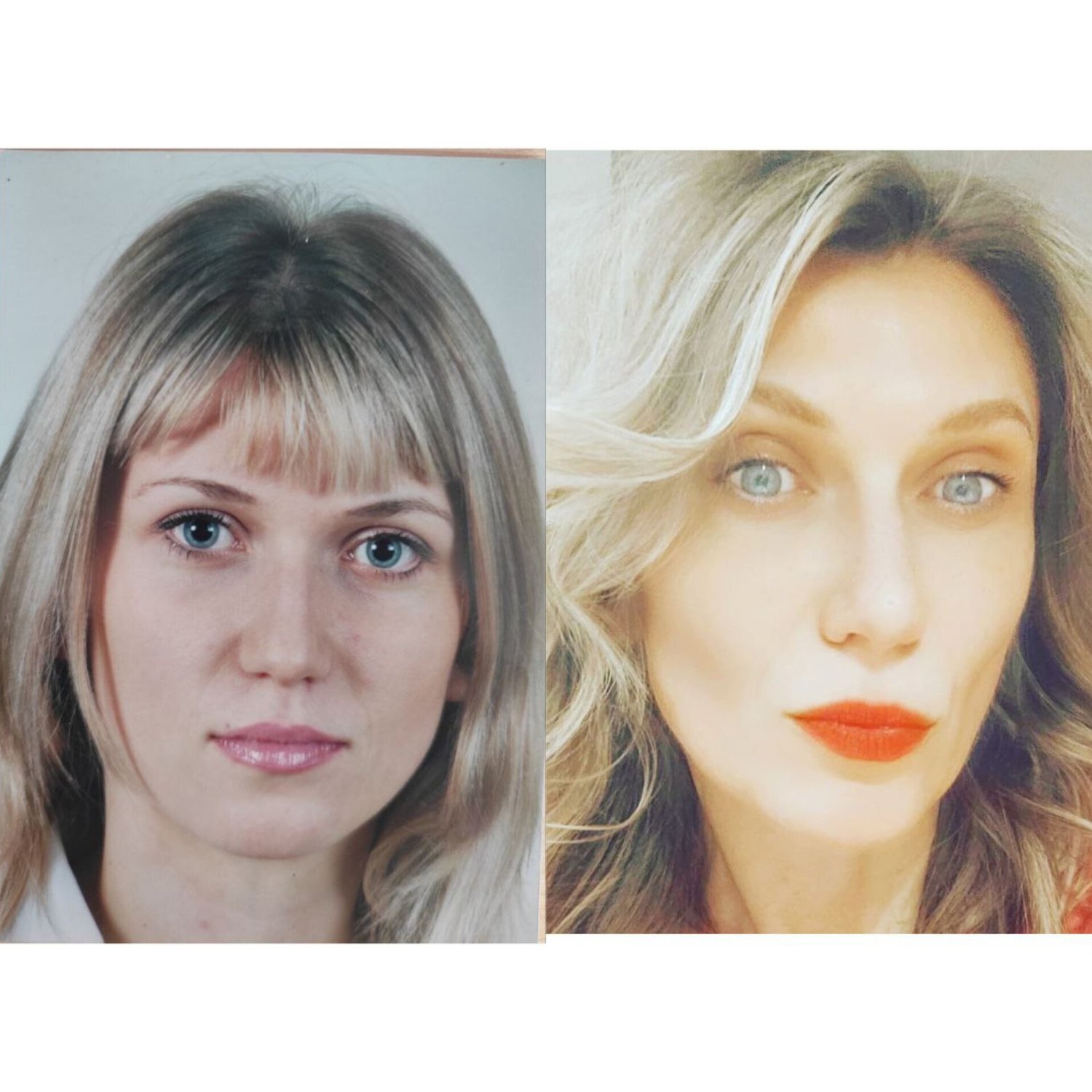 Risultato prima e dopo ginnastica facciale professionale, liftning naturale viso effetto antiage senza chirurgia.