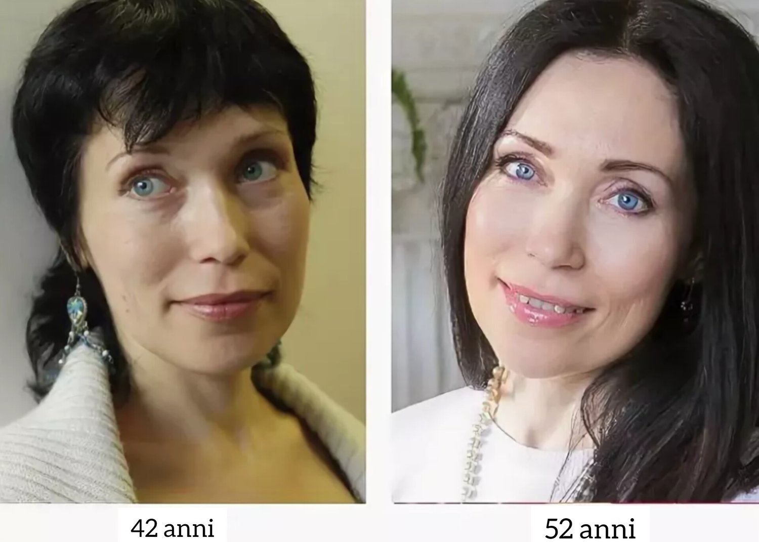 Prima e dopo Natural Face Lift, ginnastica facciale antiage per lifting naturale del viso senza filler