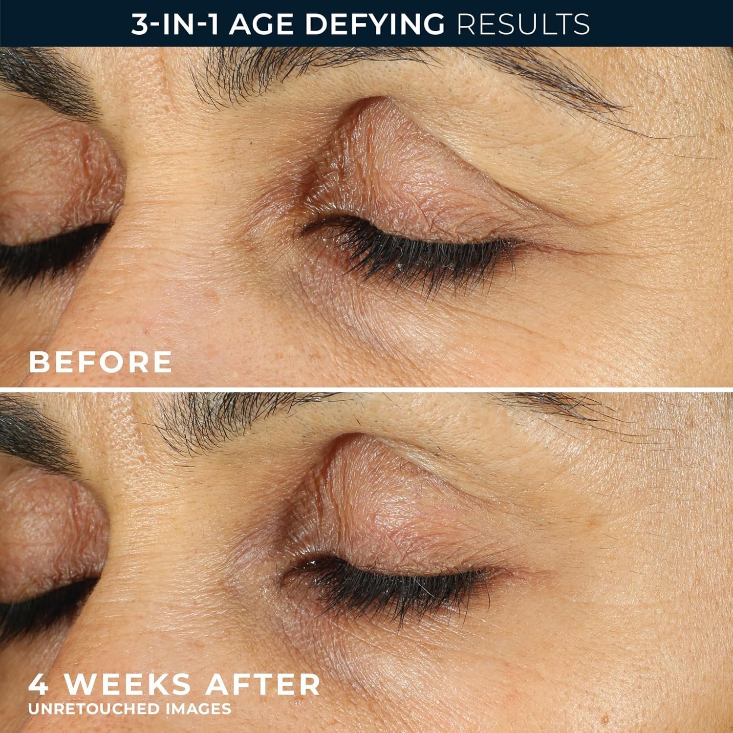 Eye Cream for Under Eyes