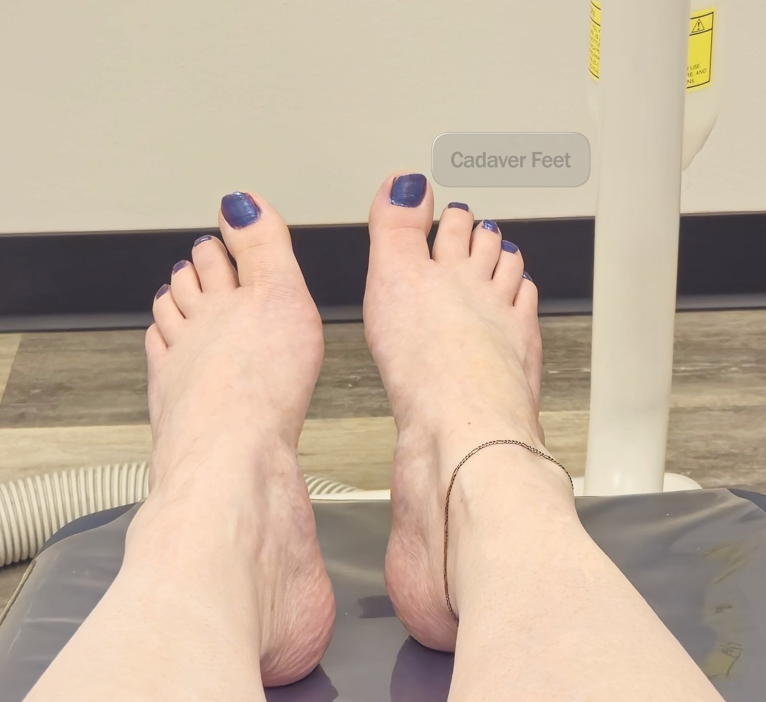 a woman laying on a dental exam chair with bare feet and dark blue nail polish and a silver anklet