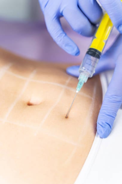Fat Dissolving Injections in Riyadh