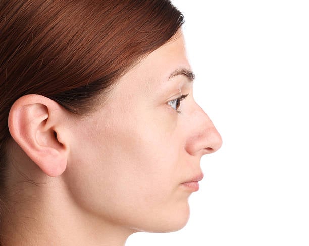 Hiko Nose Lift in Riyad