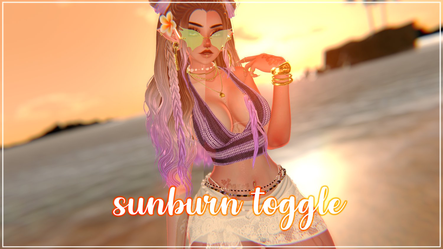 sunburn