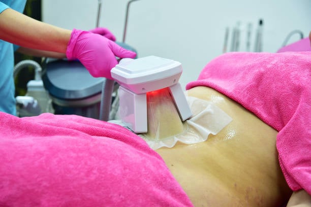 Cool Sculpting Fat Freezing in Riyadh