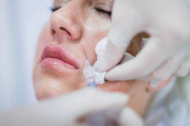 Skin Booster Treatment in Riyadh