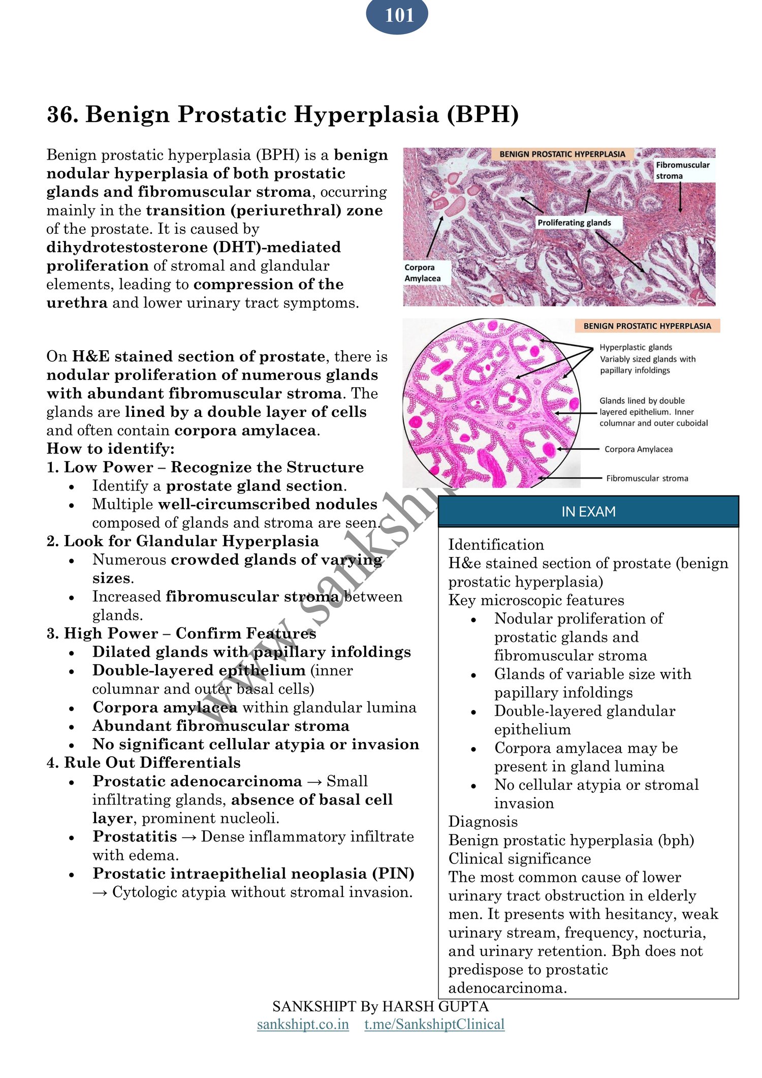 BPH slide page 1/1