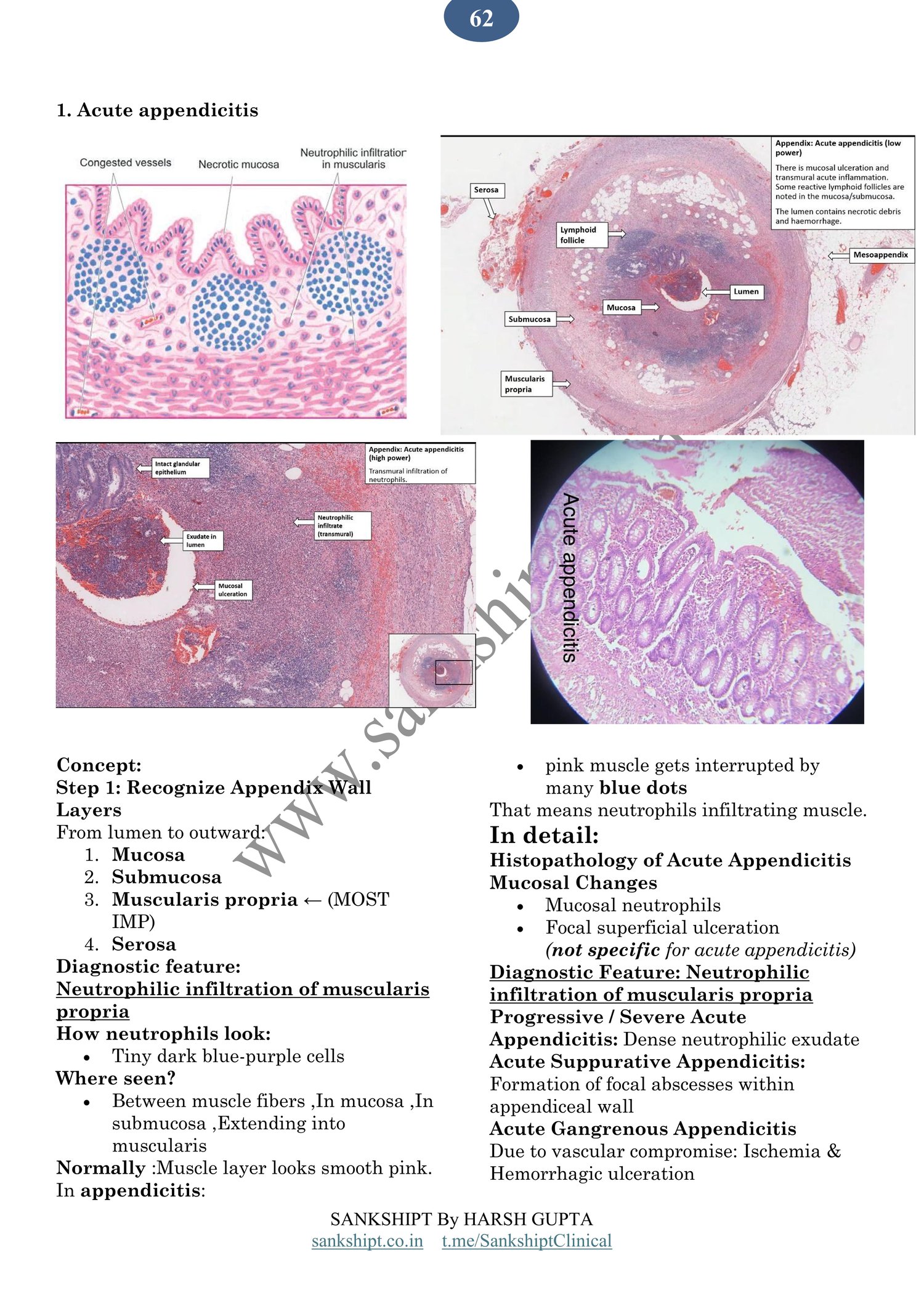 acute appendicitis page 1 of 2