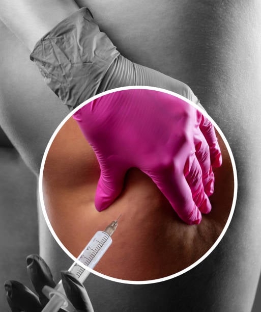 Fat dissolving injections in Riyadh