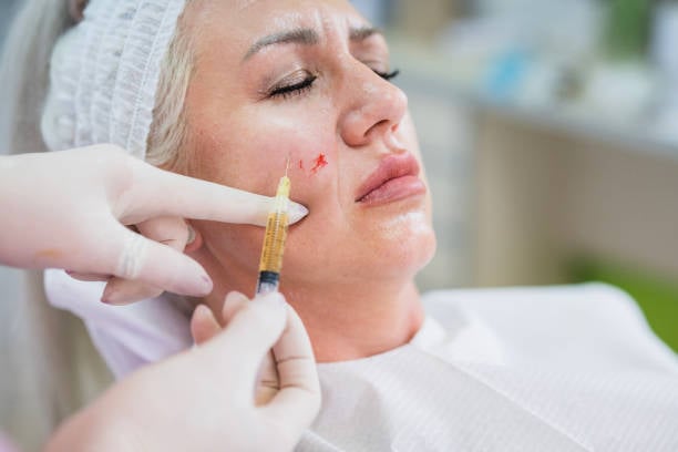 A Cell Therapy in Riyadh