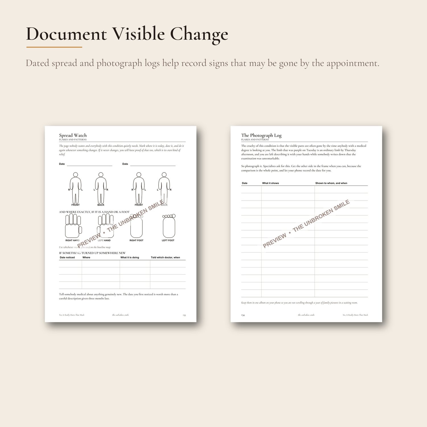 Watermarked Spread Watch and photograph log pages shown side by side.