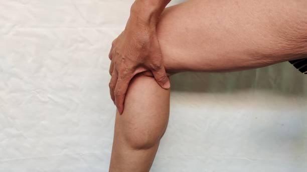 lipedema in riyadh