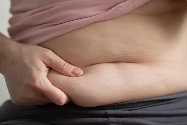 tummy tuck in riyadh