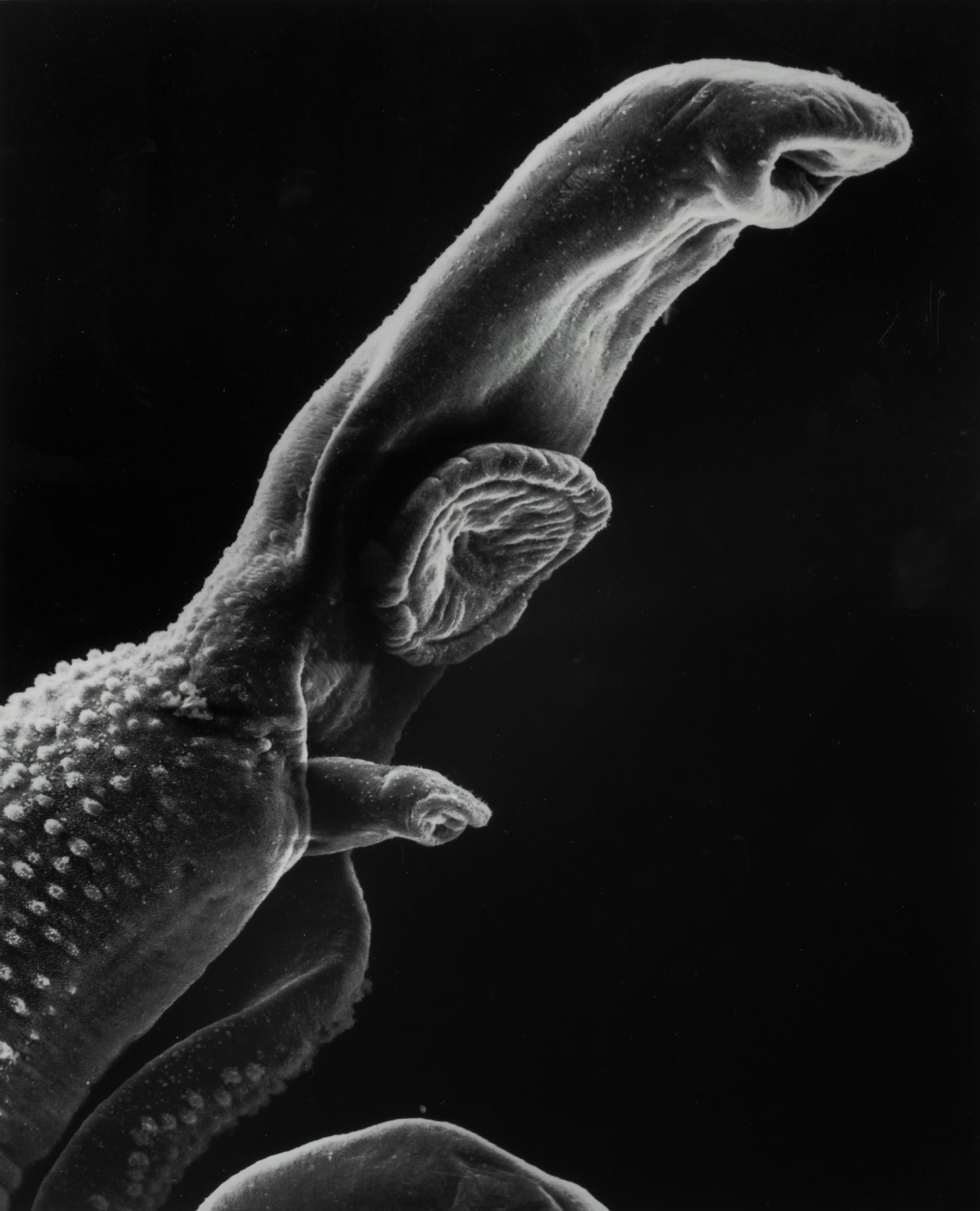 Parasites in America: The Overlooked Health Issue Affecting Millions