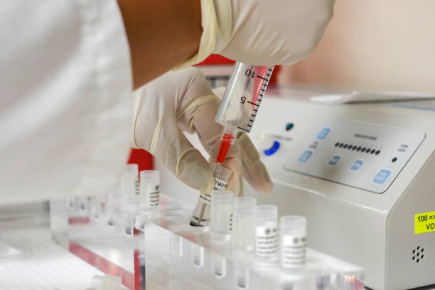 Stem cell therapy in Saudi Arabia