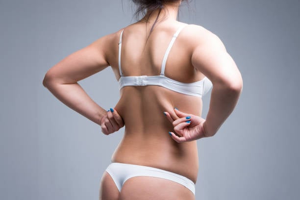 Liposuction in Riyadh