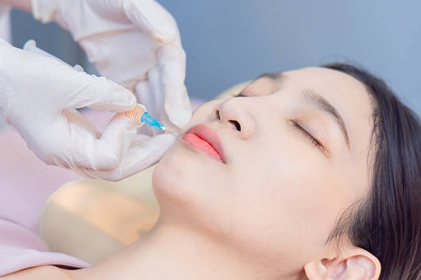 Lip Fillers in Riyadh