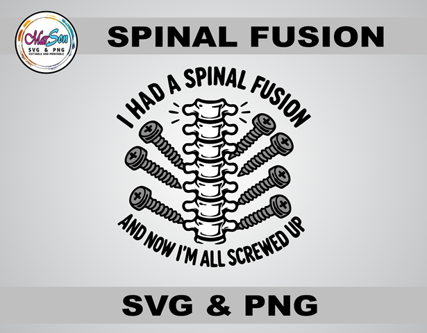 Funny spinal fusion SVG and PNG digital design for Cricut and Silhouette. Perfect for medical recovery shirts, mugs, and DIY crafts. High-quality 300 DPI transparent PNG and scalable vector file for orthopedic surgery survivors and humor lovers.
