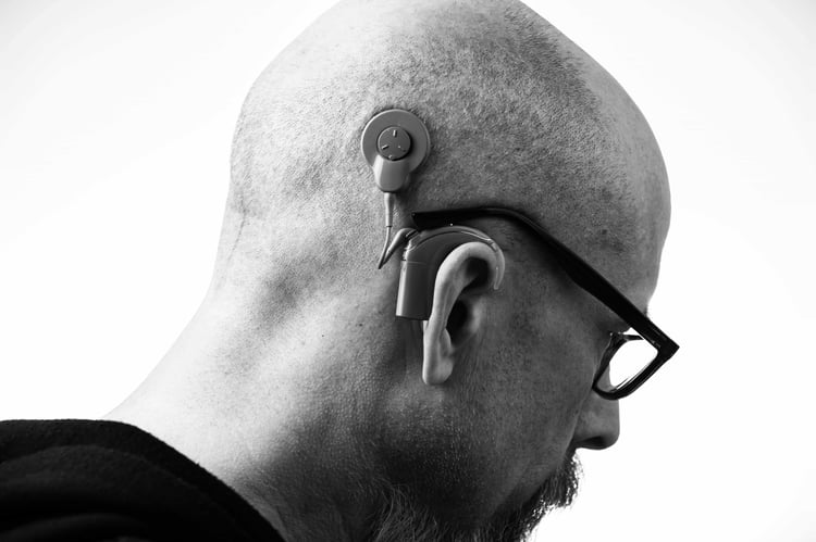 A man wearing his cochlear implant to improve his hearing capabilities