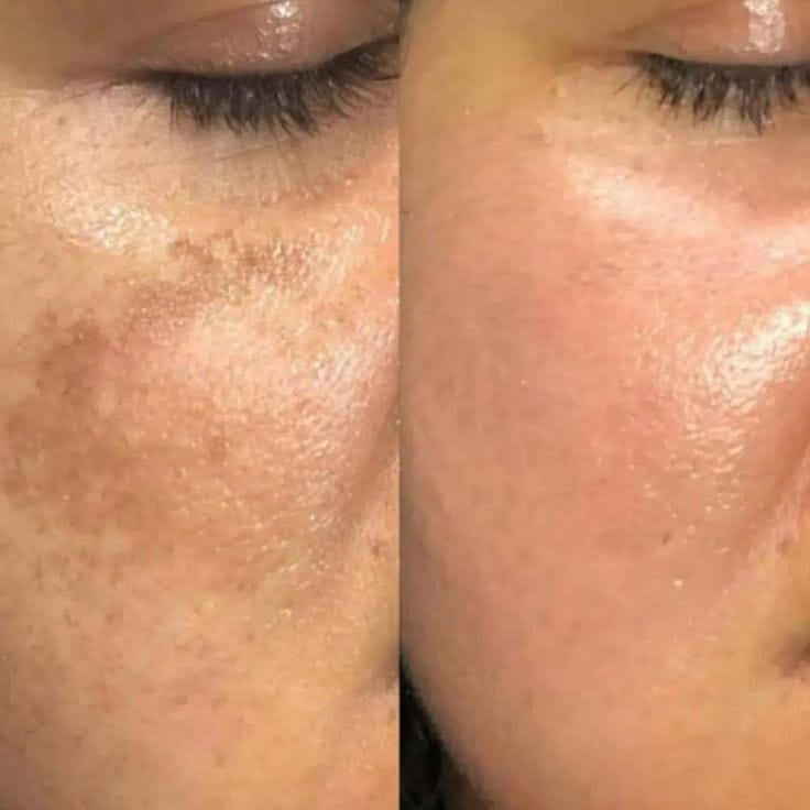 Before &  After 3 months following my book recipes