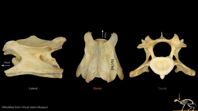 Multiple views of a cervical or neck vertebra