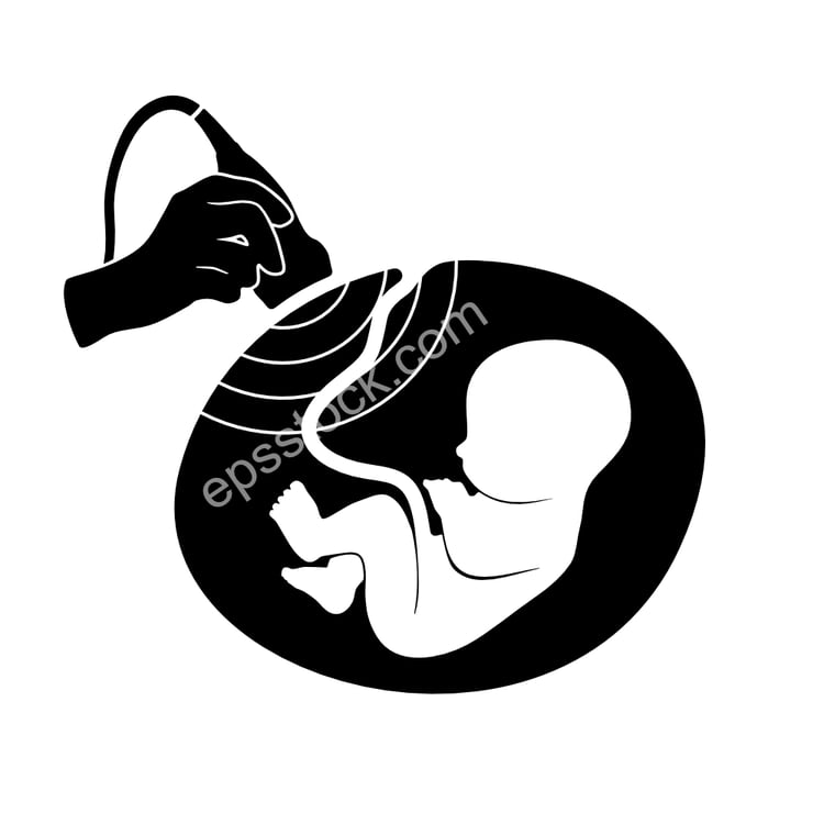 Ultrasound of a pregnant