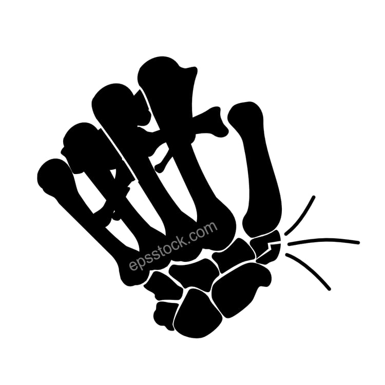 Wrist fracture