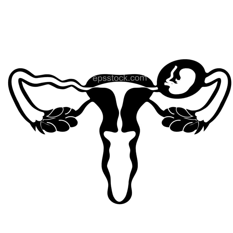 Ectopic pregnancy