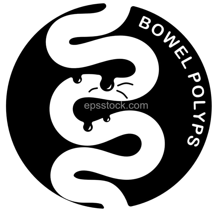 Bowel polyps