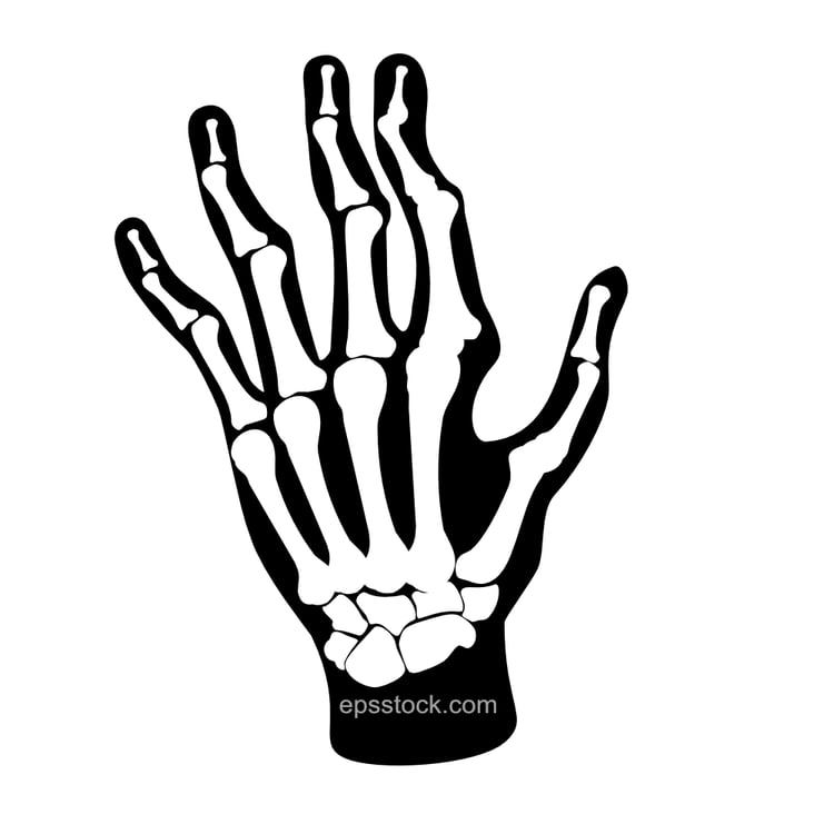 Arthritis symbol
