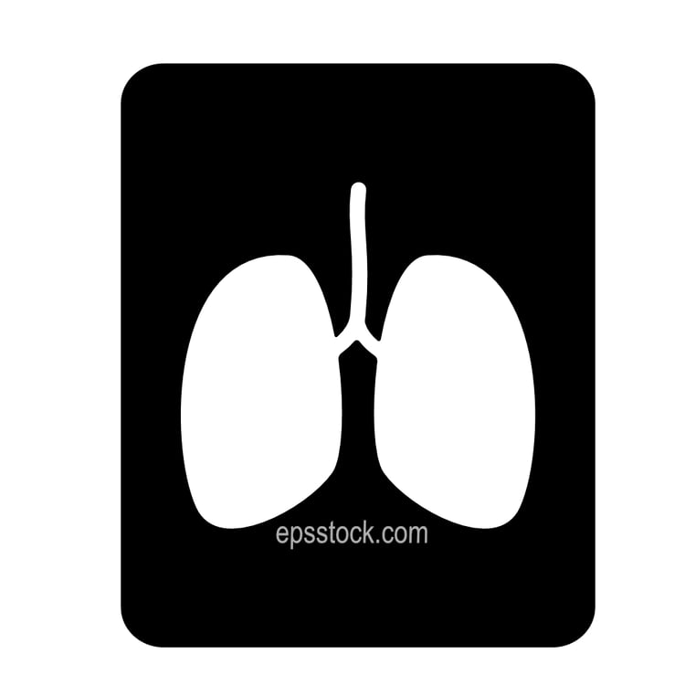 X-ray of lungs
