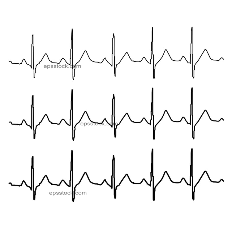cardiogram line