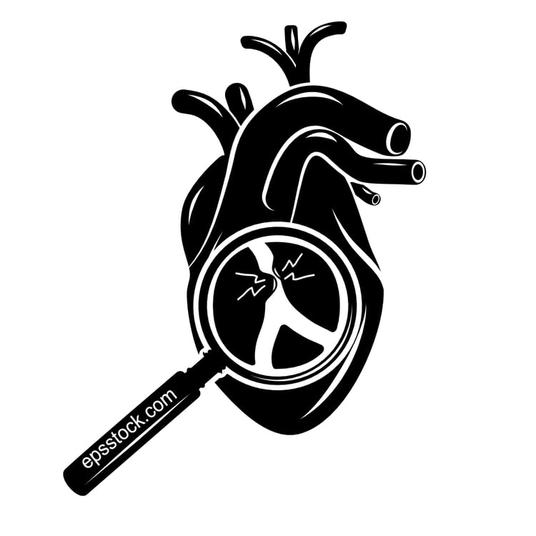 Myocardial infarction