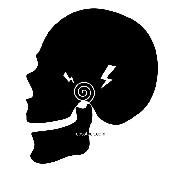 TMD (temporomandibular disorders) Disorders