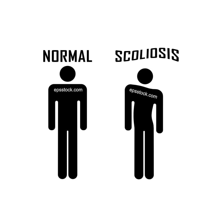 scoliosis emblem