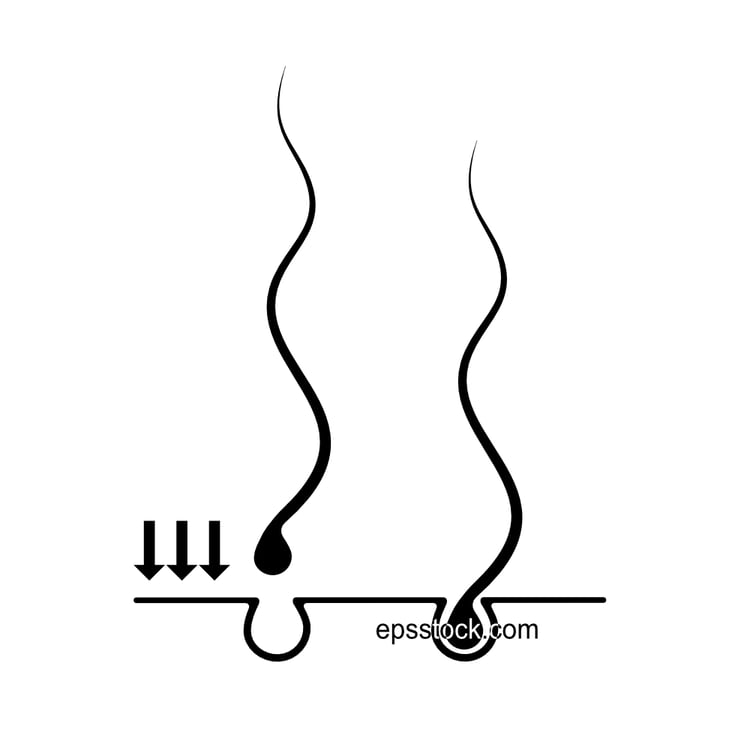 hair transplantation