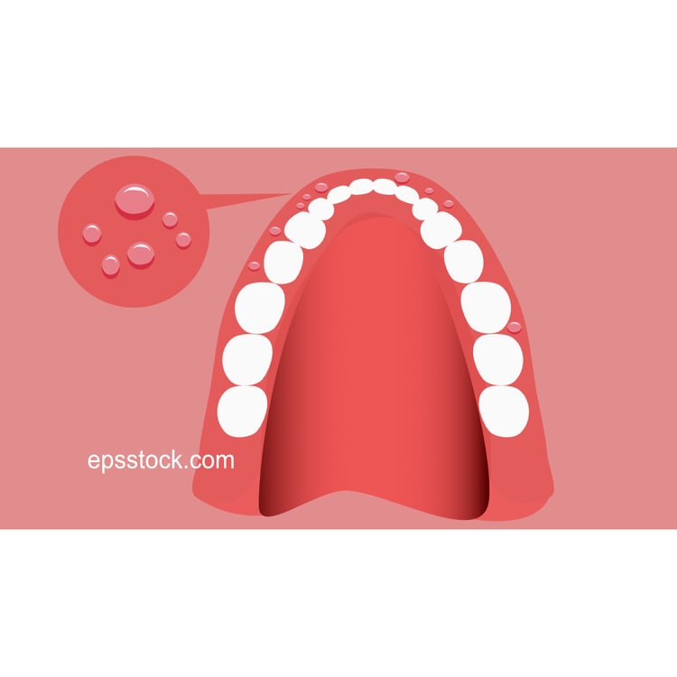 disease of the oral mucosa