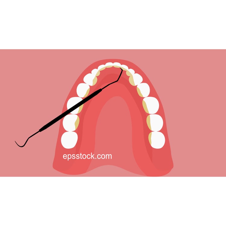 Tooth Stone Cleaning
