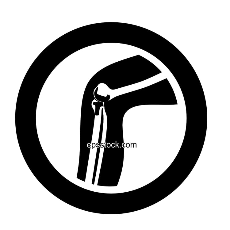 Knee replacement surgery