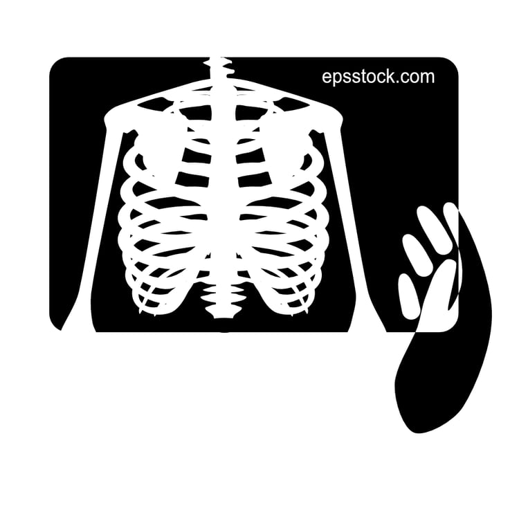 Hand and Lung x-ray, fluorography