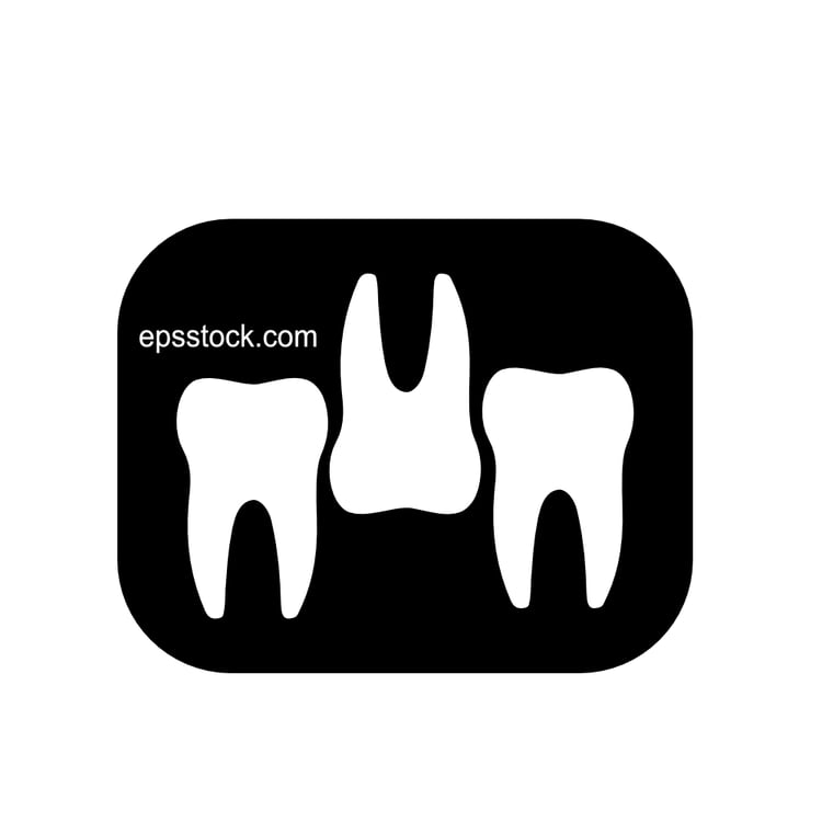 Tooth x-ray