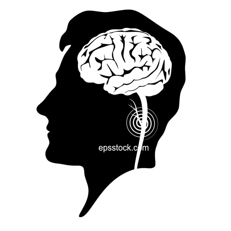 Cerebrovascular disease ischemic
