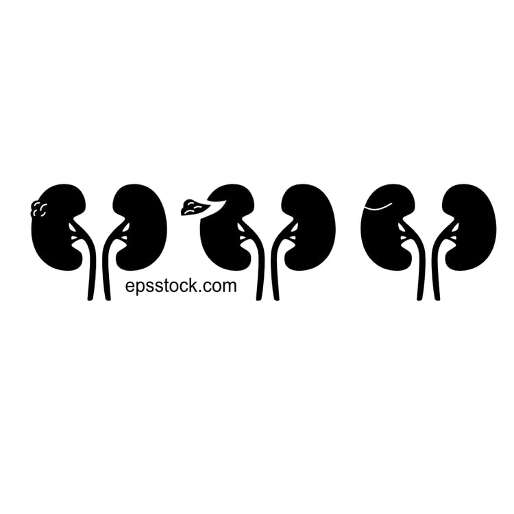 nephrectomy kidney, black isolated silhouette