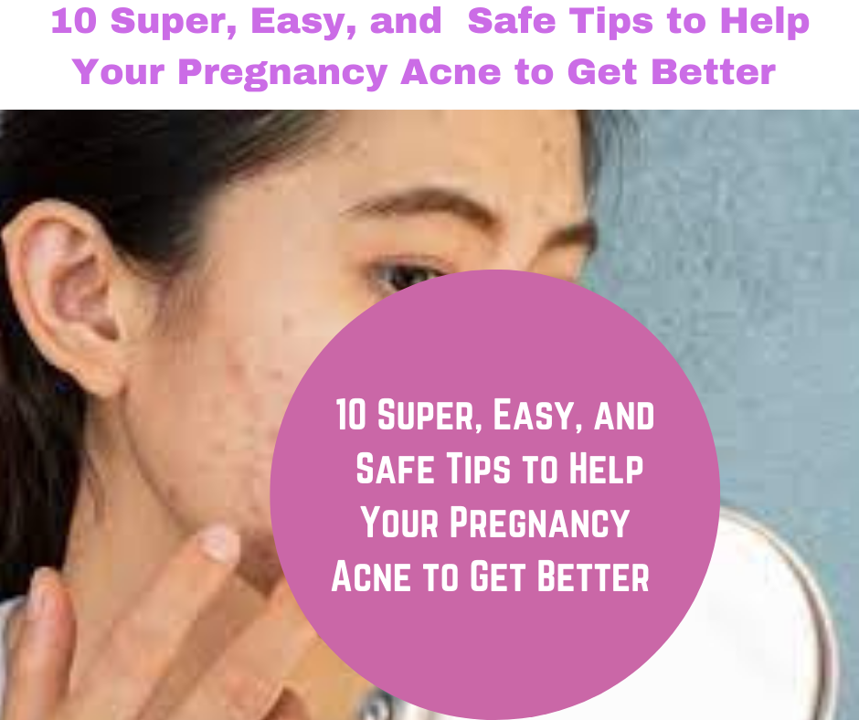 Are you experiencing acne during your pregnancy? 10 Super, Easy, and  Safe Tips to Help Your Pregnancy Acne to Get Better .