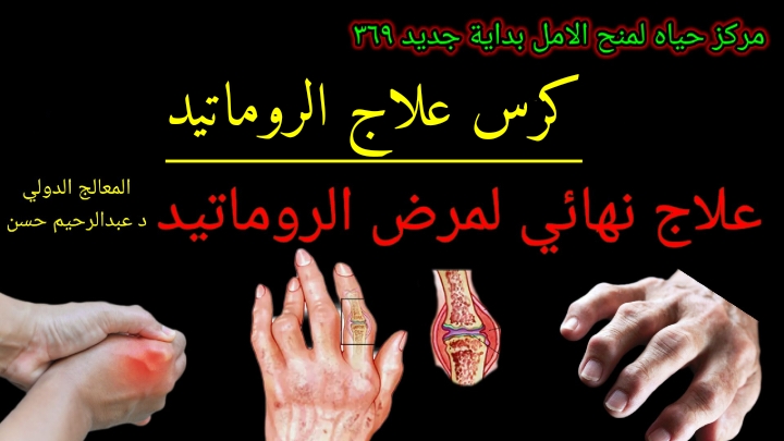 كرس علاج كامل للروماتيد وضبط المناعة وبناء الغضاريف والاوتار