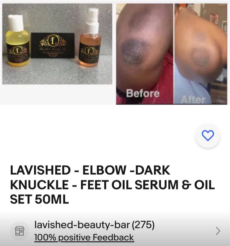 Clear All Dark Knuckles, Elbows, Knees, Feet Oil - Turmeric & Natural Ingredients - 1 Bottle