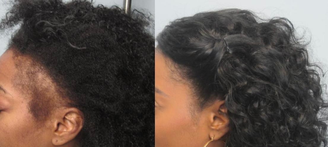 Africa's Best Maximum Strength Super Gro Hair & Scalp Conditioner, 5.25 oz (Pack of 2)