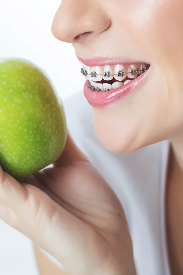 Orthodontics in Riyadh