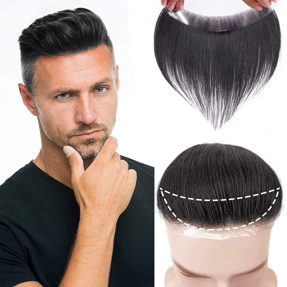 Hair systems for men