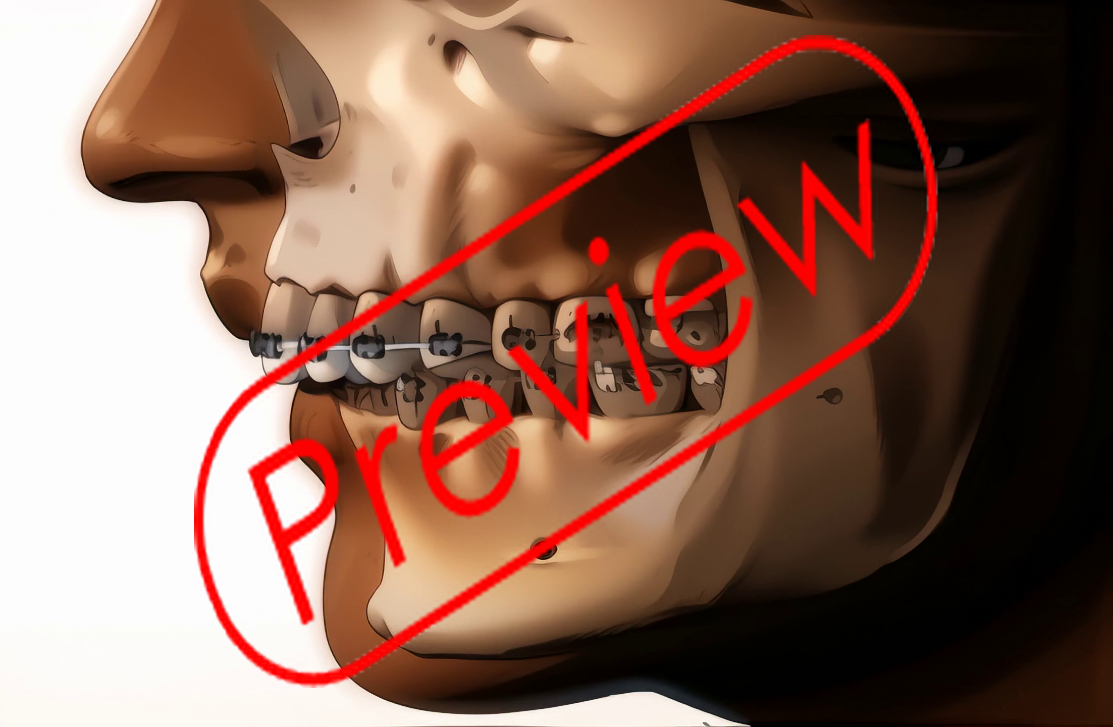 Dental Anime Orthodontics f337 - Payhip