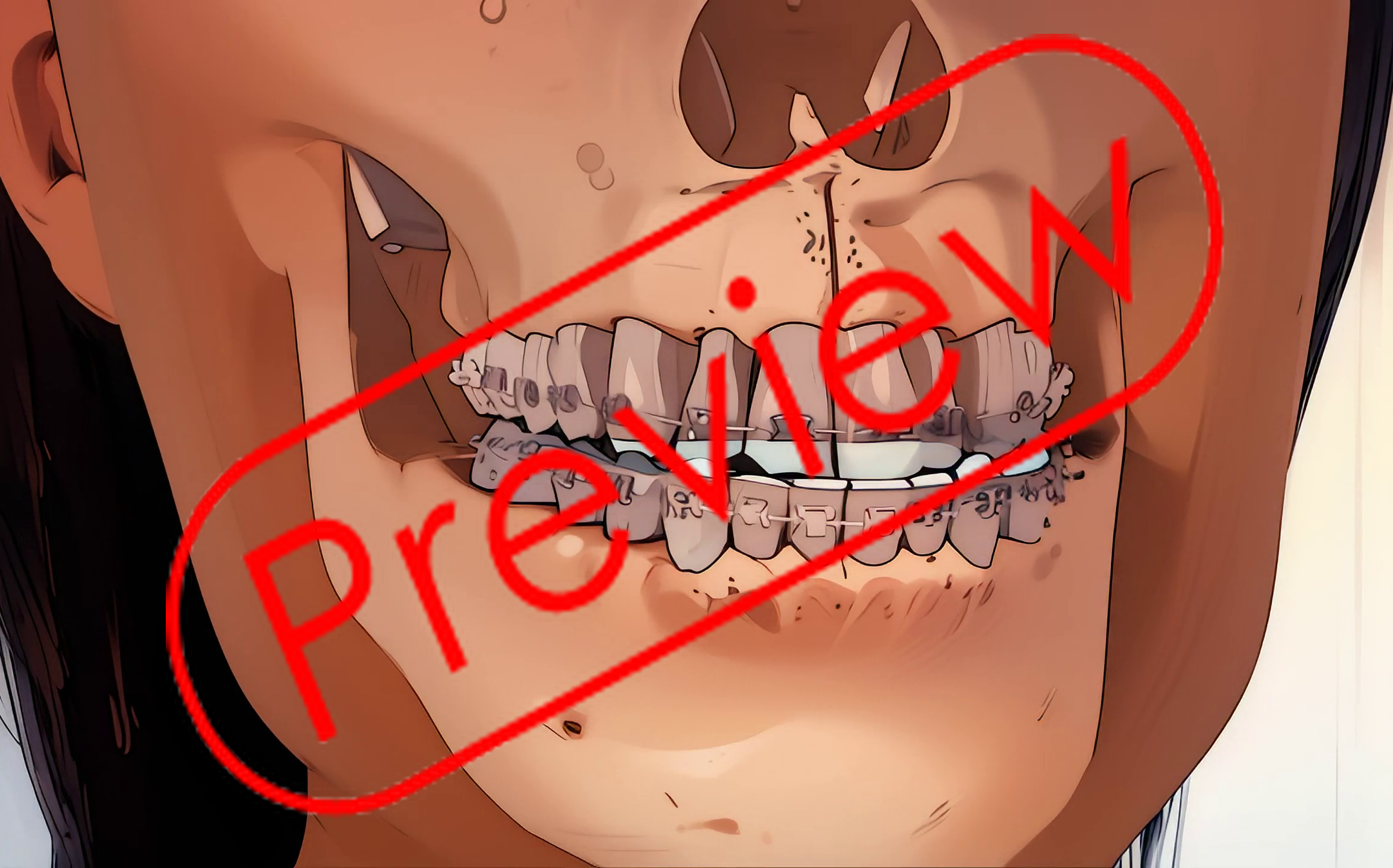 Dental Anime Orthodontics Surgery 12p2 - Payhip